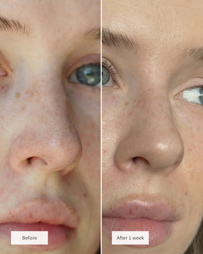 2-delt shorts sæt til afslapning